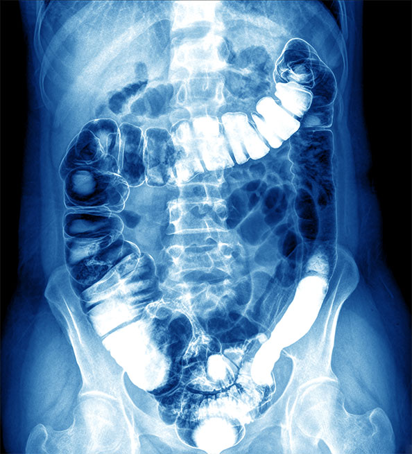 abdominal scan in encino